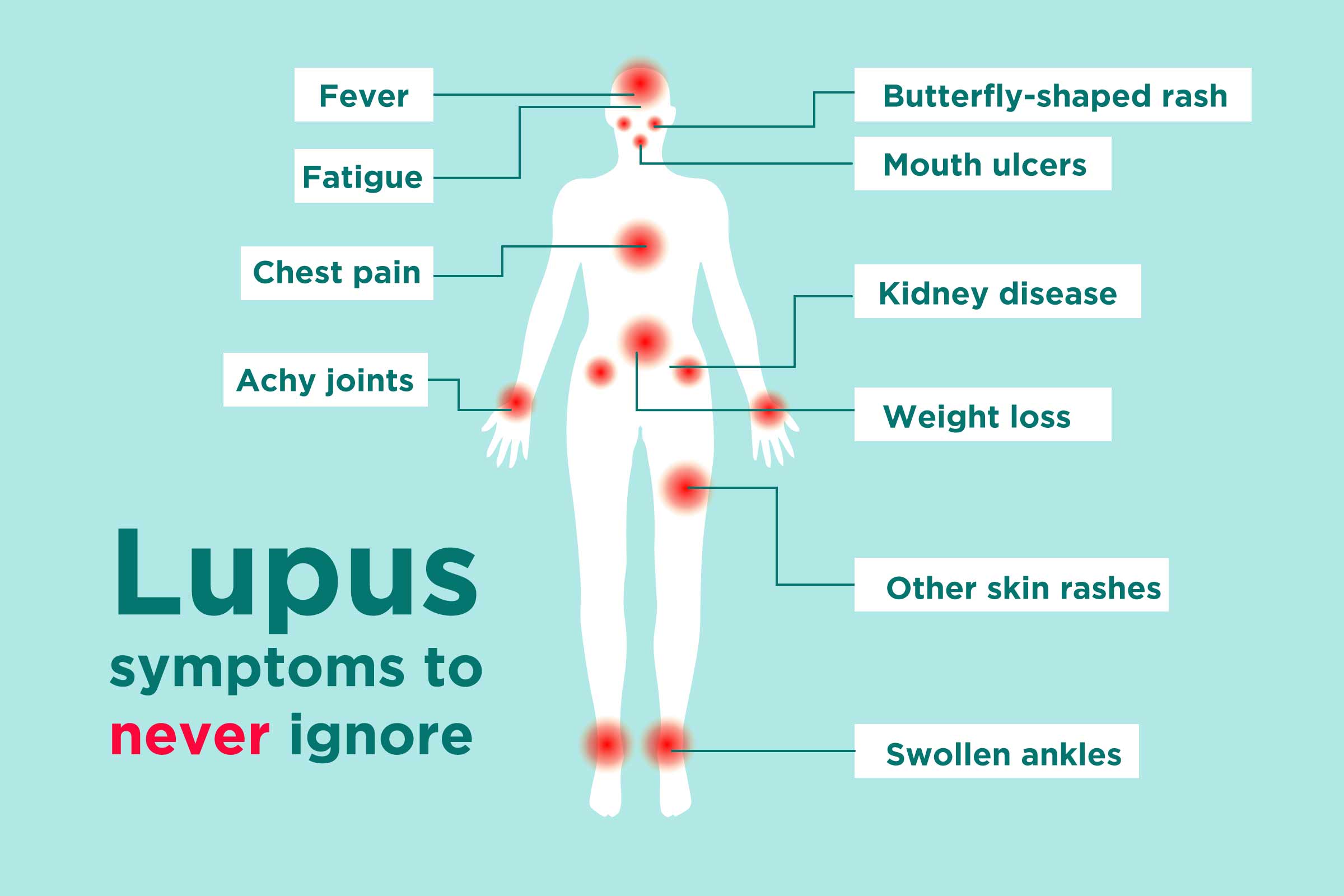 0219_Lupus-Symptoms