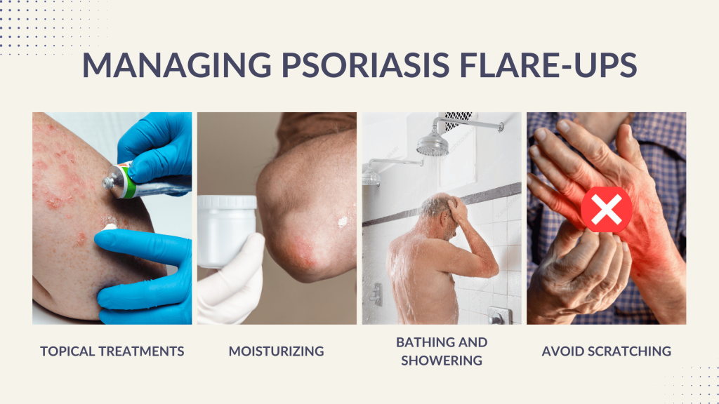 Managing-Psoriasis-Flare-Ups-1024×576