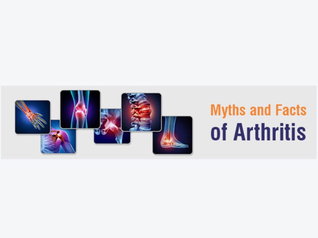 Myths-and-Facts-of-Arthritis-1-1200×900