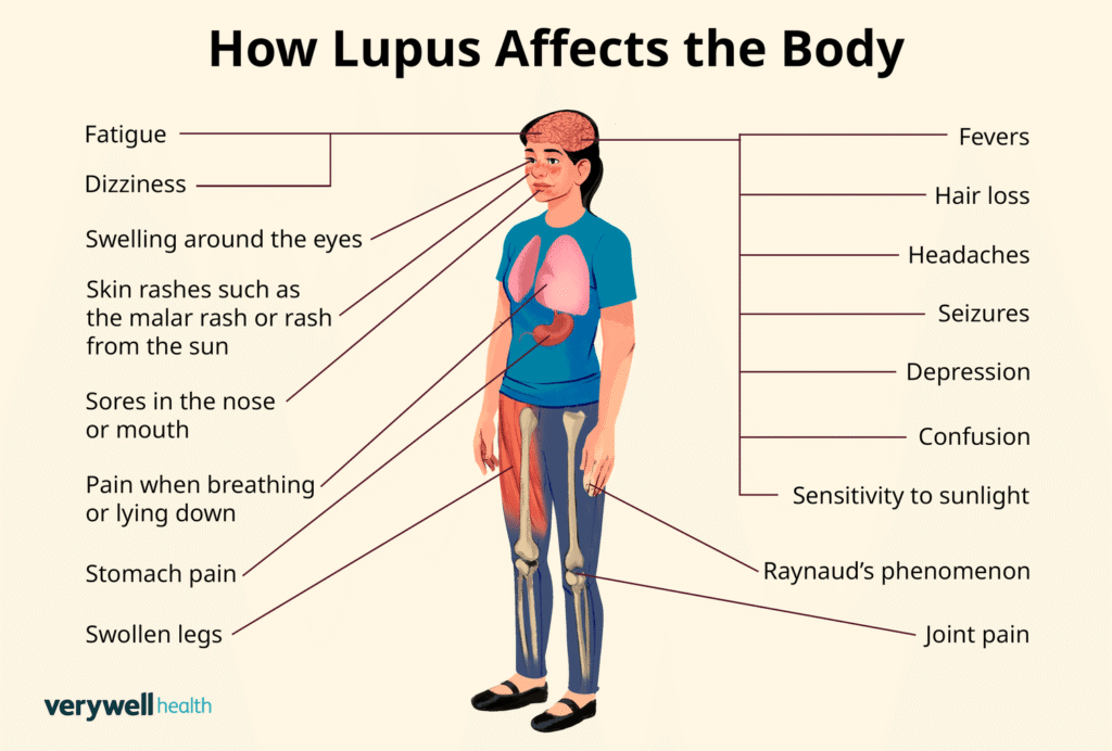 VWHNewCreate-Lupus-e80d89d3b3ff4b38b798f9e84468f04c
