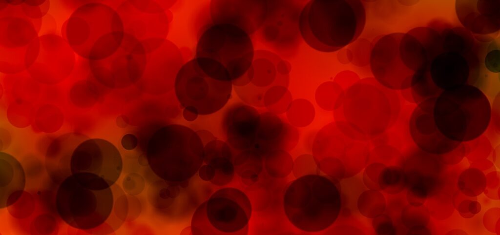 DVT / Blood Clots