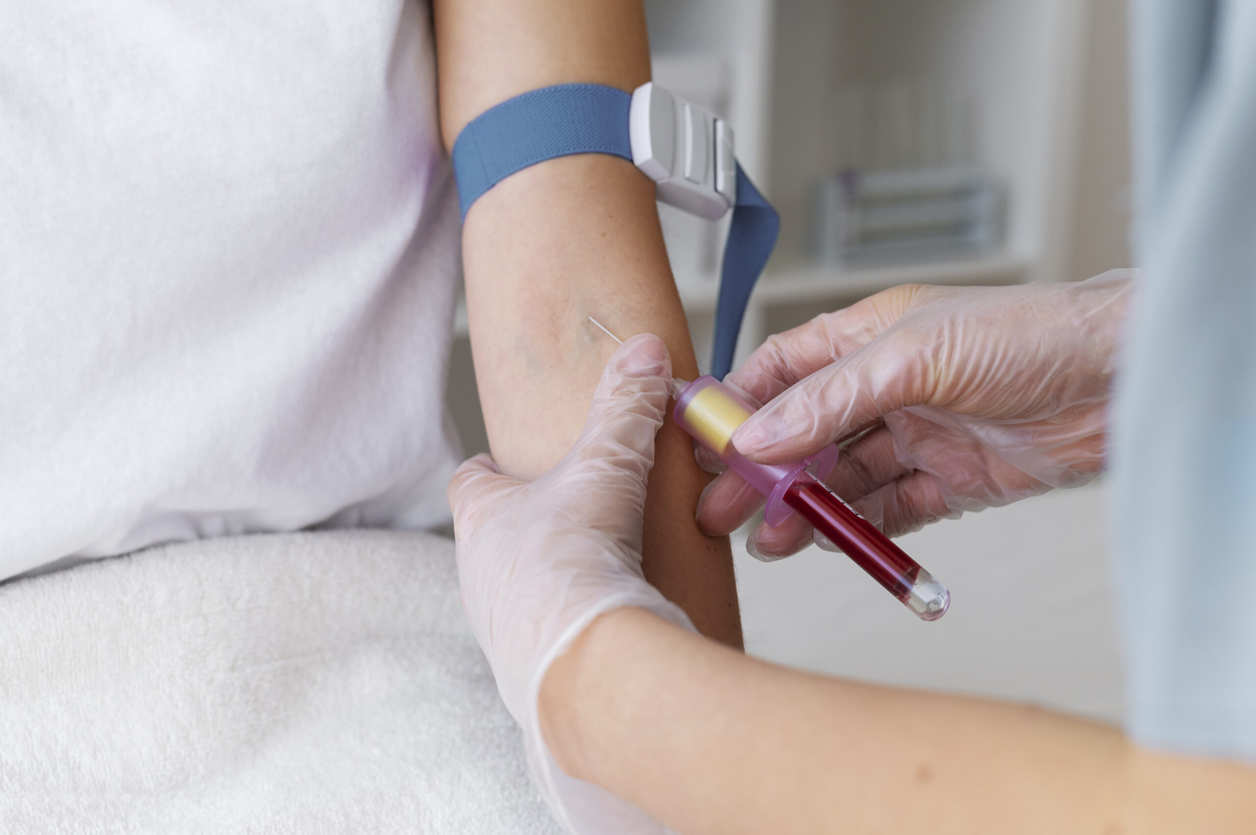 DVT risk