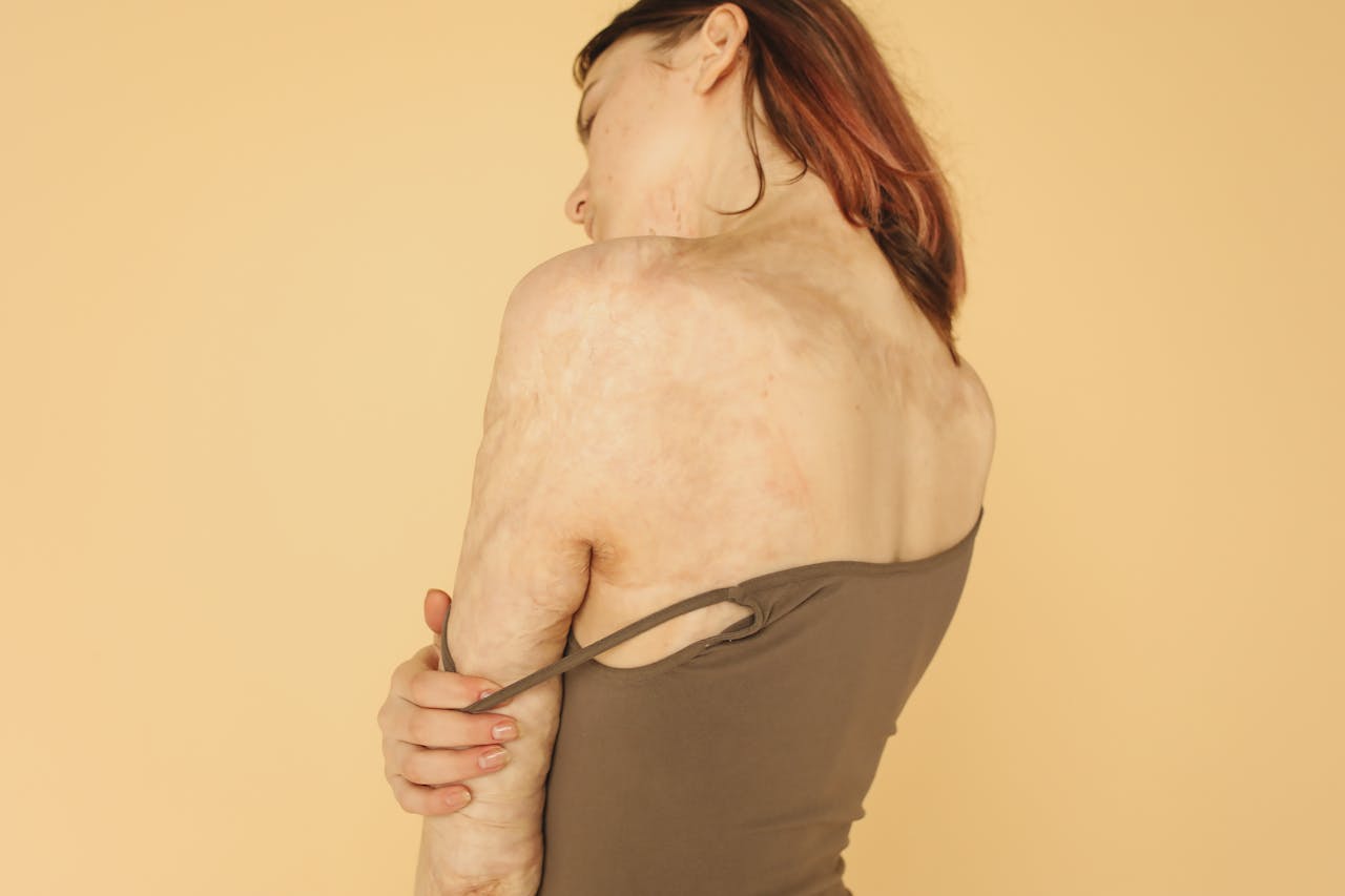 genital skin issues