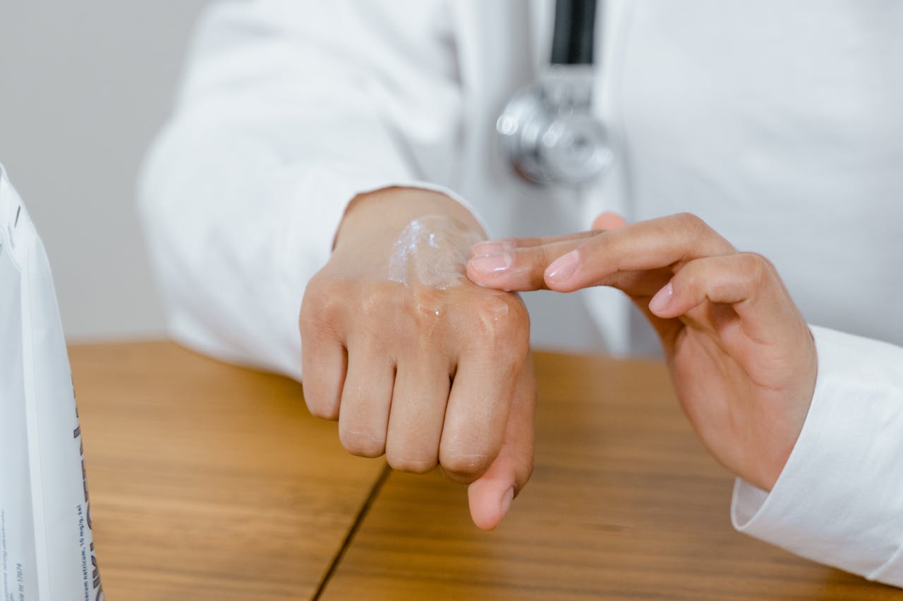 Eczema