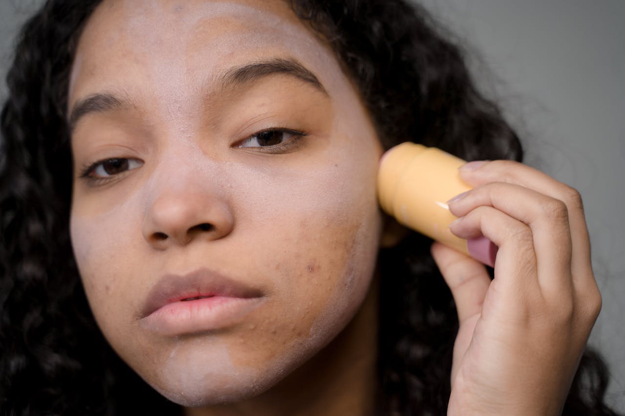 Skin Problems